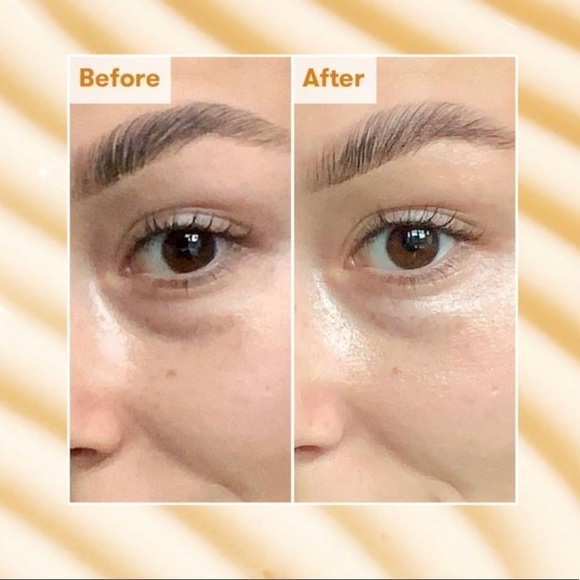 REN Clean Skincare Brightening Dark Circle Eye Cream | NEW | Full Size | BNIB - Picture 6 of 14